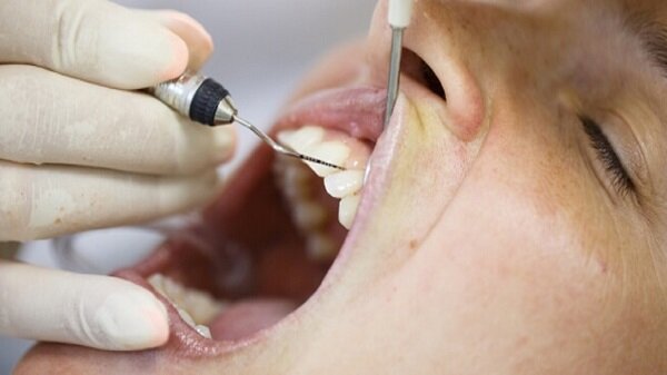مبتلایان دیابت در معرض بیمارهای دهان و دندان