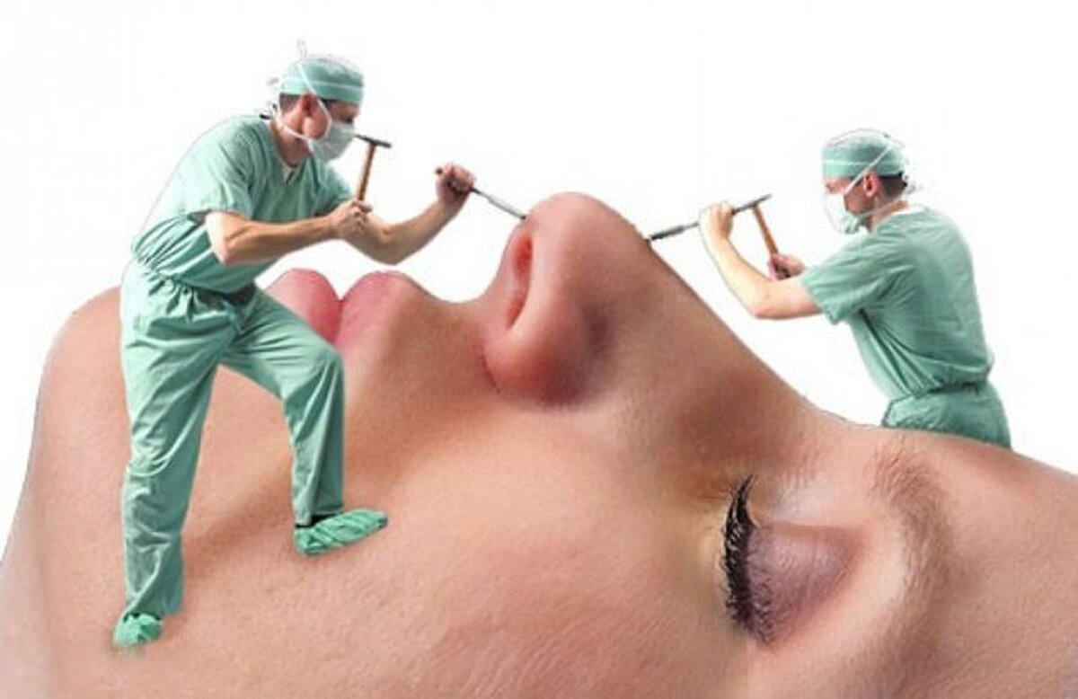 افزایش تقاضا برای جراحی زیبایی صورت!