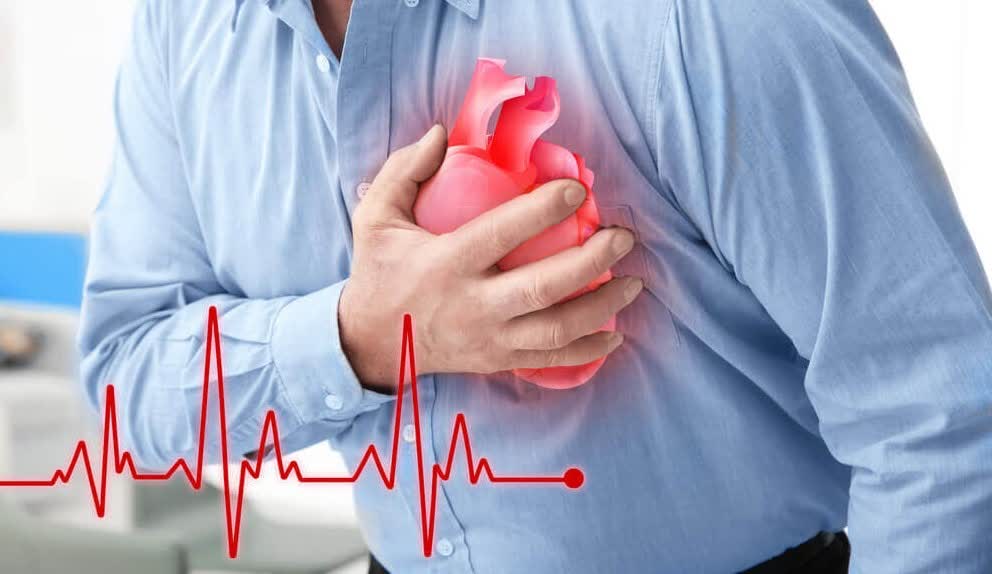 علت کاهش سن سکته قلبی به ۳۰ سال چیست؟