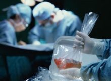 چالش اهدای عضو با مرگ صابر کاظمی