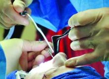 هشدار نظام پزشکی به رشد قارچ‌گونه مراکز غیرمجاز!